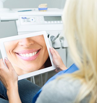 Woman looking at smile design on computer