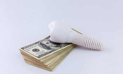 dental implant on money