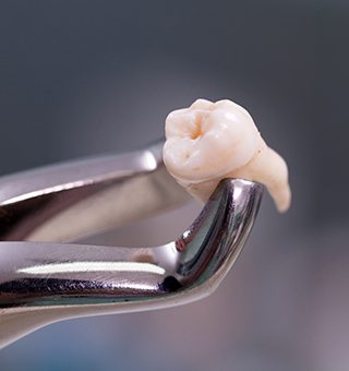 Metal clasp holding extracted tooth