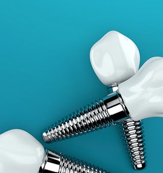 Three animated implant supported dental crowns