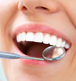 Closeup of healthy smile